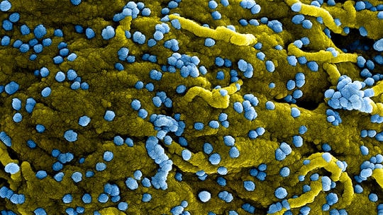 WHO tăng cường giám sát sau khi Guinea Xích đạo công bố dịch bệnh do virus Marburg